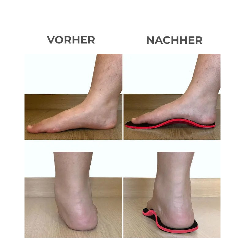 Fußgewölbestützen